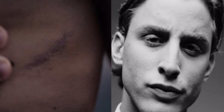 博维在球场, 创造属于你, 受了心脏手 博维在球场, 创造属于你, 受了心脏手